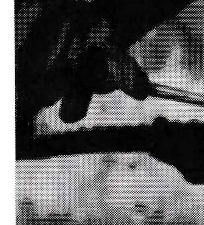 A rope under full tension has an entire loose strand with surrounding loose wires on the other strands 30 feet ahead of the leading tuck of the splice.